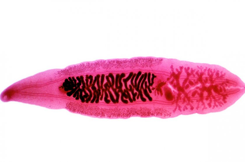 Clonorchis sinensis