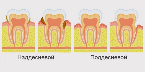 Зубной камень у котов лечение и удаление